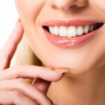 Dental Veneers